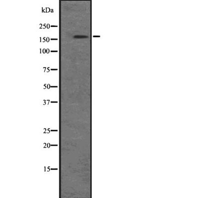 PIK3C2B Antibody in Western Blot (WB)