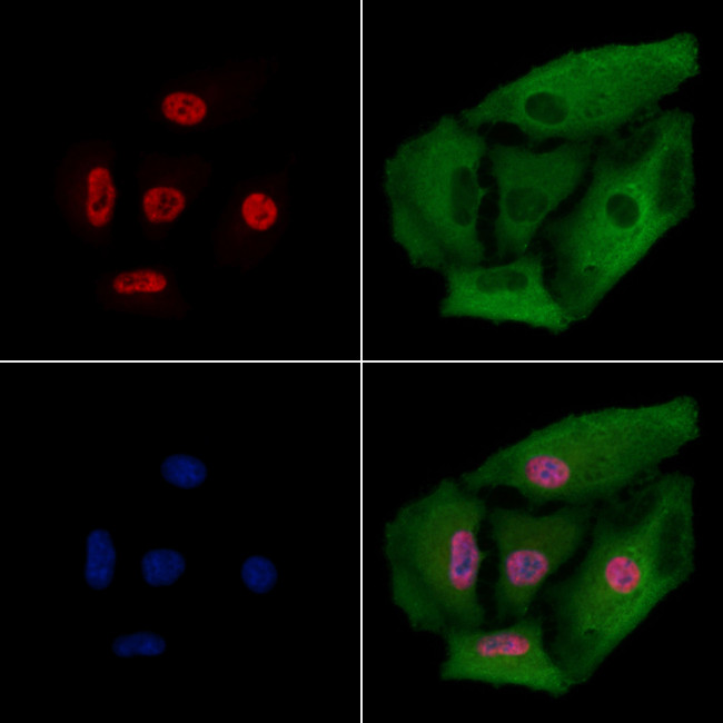 FUBP1 Antibody in Immunocytochemistry (ICC/IF)