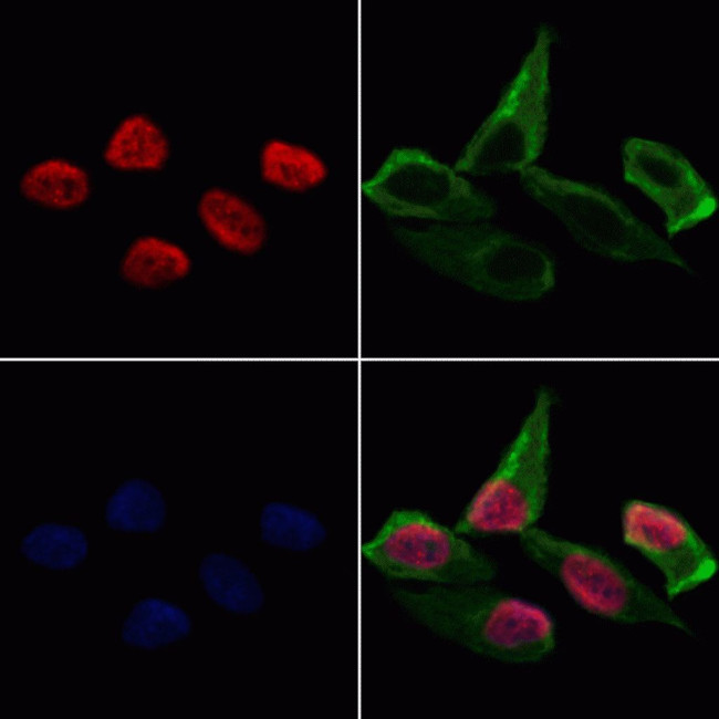 HDAC11 Antibody in Immunocytochemistry (ICC/IF)