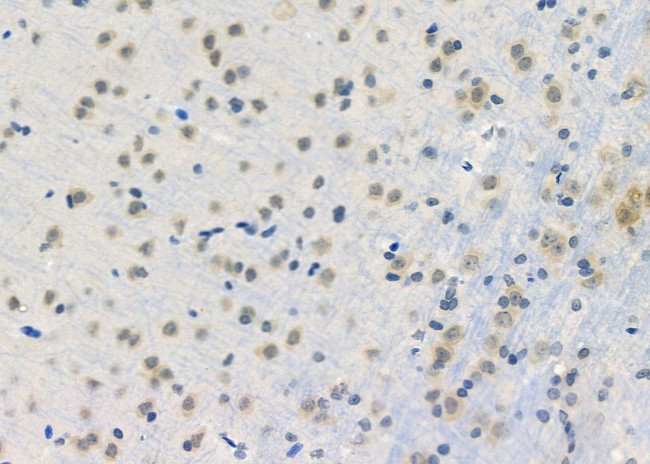 HDAC11 Antibody in Immunohistochemistry (Paraffin) (IHC (P))