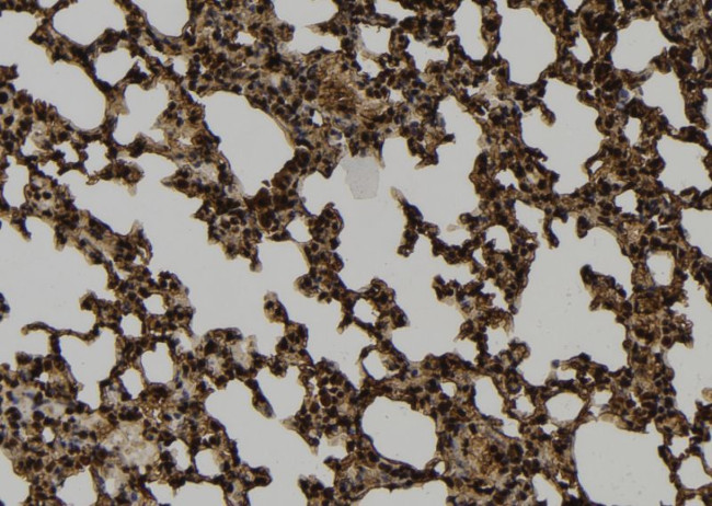 PRC1 Antibody in Immunohistochemistry (Paraffin) (IHC (P))