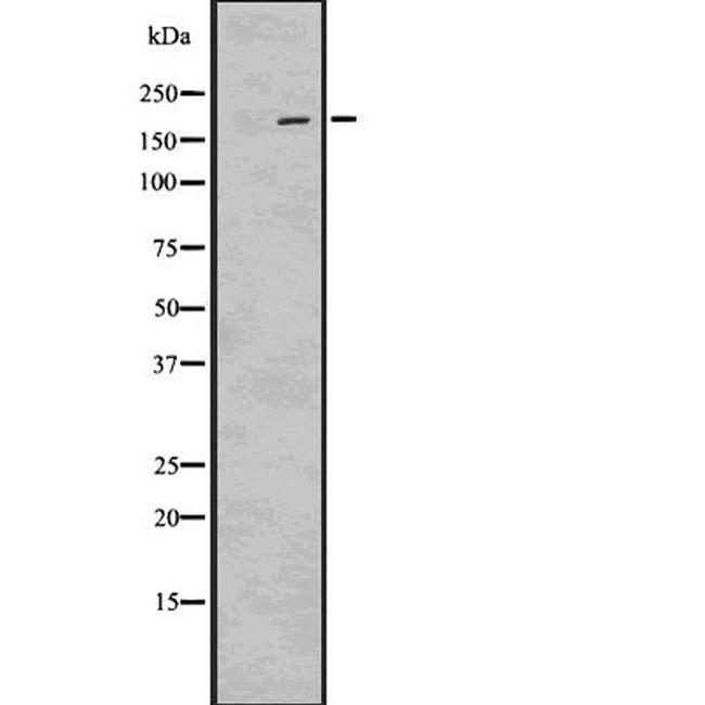 Phospho-LRP6 (Ser1490) Antibody in Western Blot (WB)