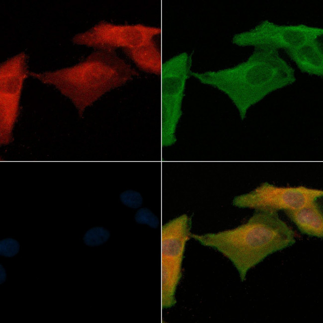 PTX3 Antibody in Immunocytochemistry (ICC/IF)