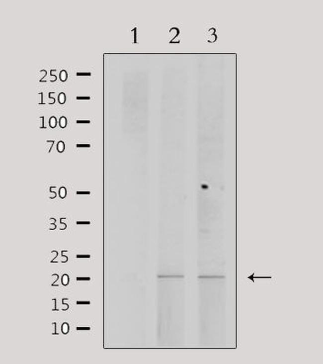 PPP1R14C Antibody in Western Blot (WB)