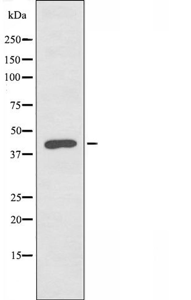 FOXB1/FOXB2 Antibody in Western Blot (WB)