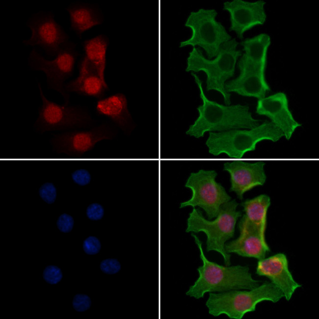 API5 Antibody in Immunocytochemistry (ICC/IF)