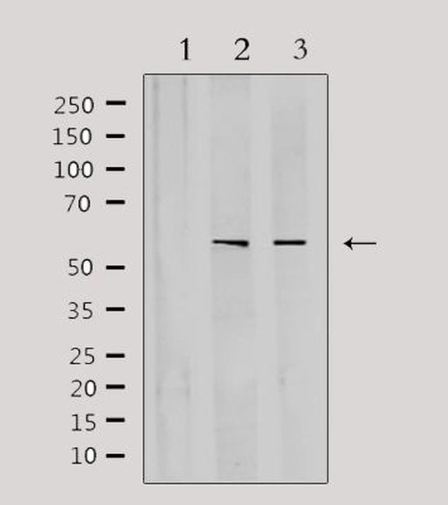 CYP3A4/CYP3A5 Antibody in Western Blot (WB)