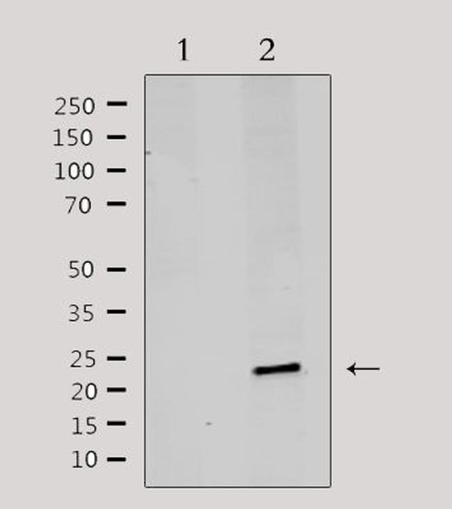 MRPL20 Antibody in Western Blot (WB)