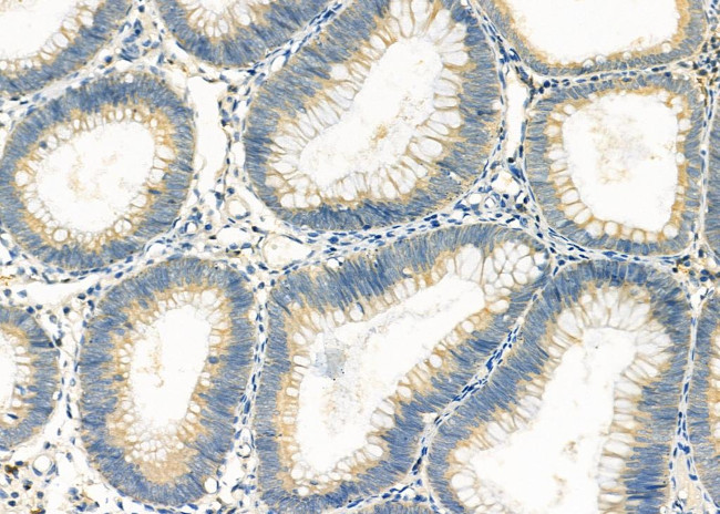 RPS4Y1 Antibody in Immunohistochemistry (Paraffin) (IHC (P))