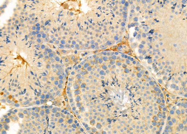 RPS4Y1 Antibody in Immunohistochemistry (Paraffin) (IHC (P))