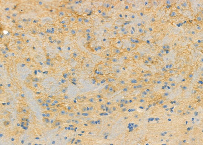 RPS4Y1 Antibody in Immunohistochemistry (Paraffin) (IHC (P))