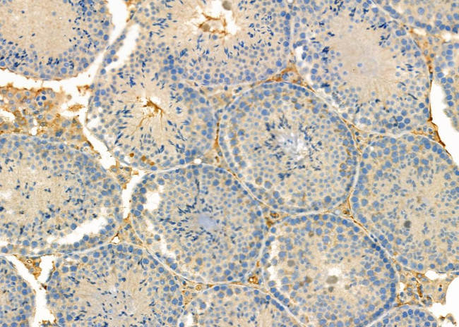 RPS4Y1 Antibody in Immunohistochemistry (Paraffin) (IHC (P))