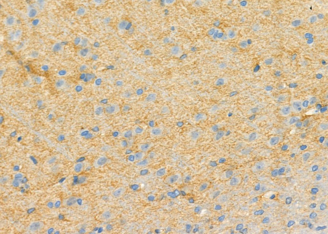 RPS4Y1 Antibody in Immunohistochemistry (Paraffin) (IHC (P))