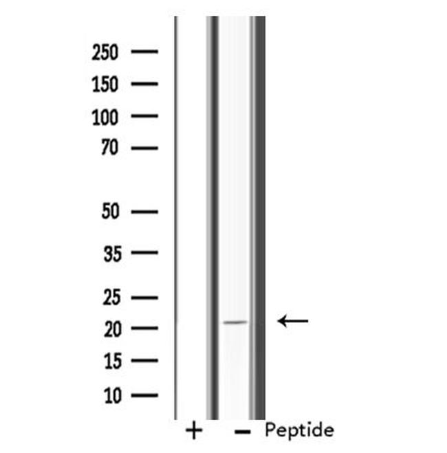 RPL11 Antibody in Western Blot (WB)