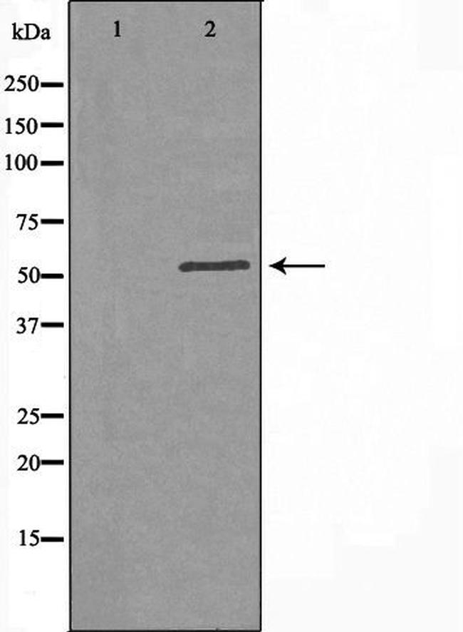 B3GALTL Antibody in Western Blot (WB)