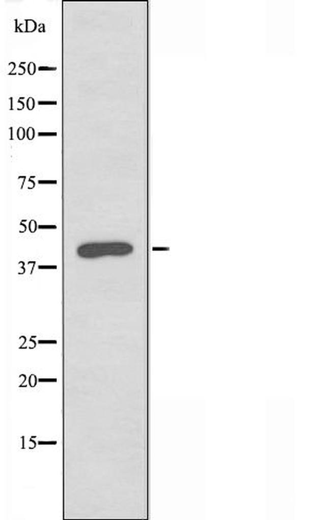 LFNG Antibody in Western Blot (WB)