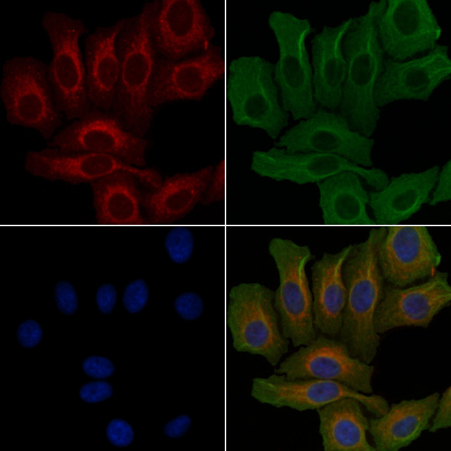 Carbonic Anhydrase VI Antibody in Immunocytochemistry (ICC/IF)