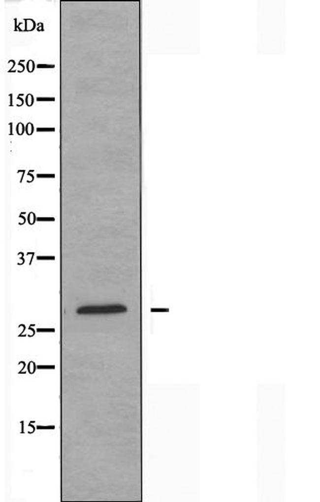 CBLN4 Antibody in Western Blot (WB)