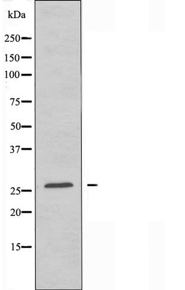 Claudin 6 Antibody in Western Blot (WB)