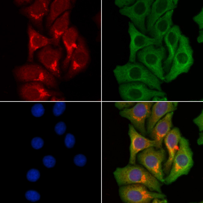 UBR1 Antibody in Immunocytochemistry (ICC/IF)