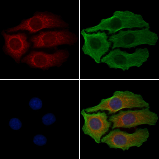 GSTT1 Antibody in Immunocytochemistry (ICC/IF)