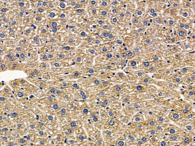 GLRB Antibody in Immunohistochemistry (Paraffin) (IHC (P))