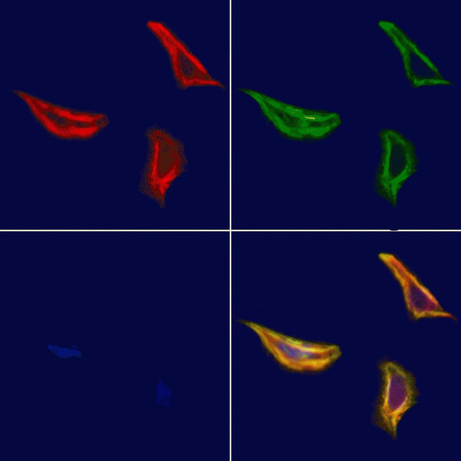 MRP7 Antibody in Immunocytochemistry (ICC/IF)