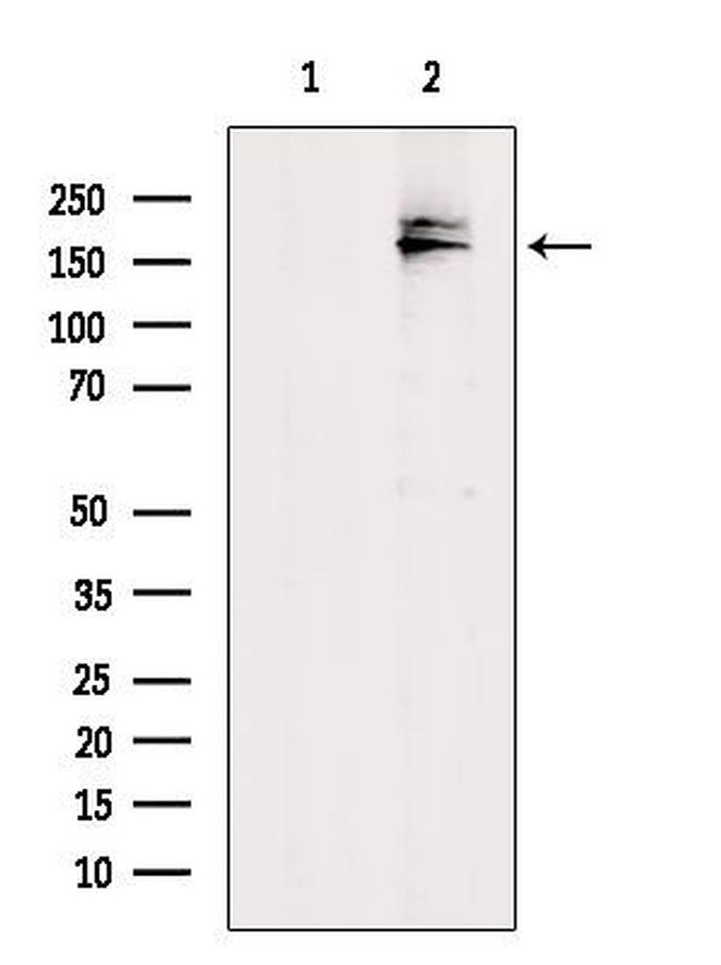 MRP7 Antibody in Western Blot (WB)