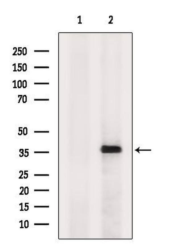 MT-ND1 Antibody in Western Blot (WB)