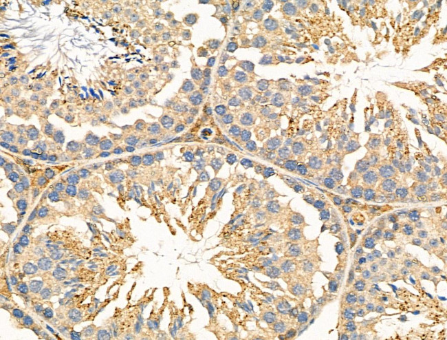 NEGR1 Antibody in Immunohistochemistry (Paraffin) (IHC (P))