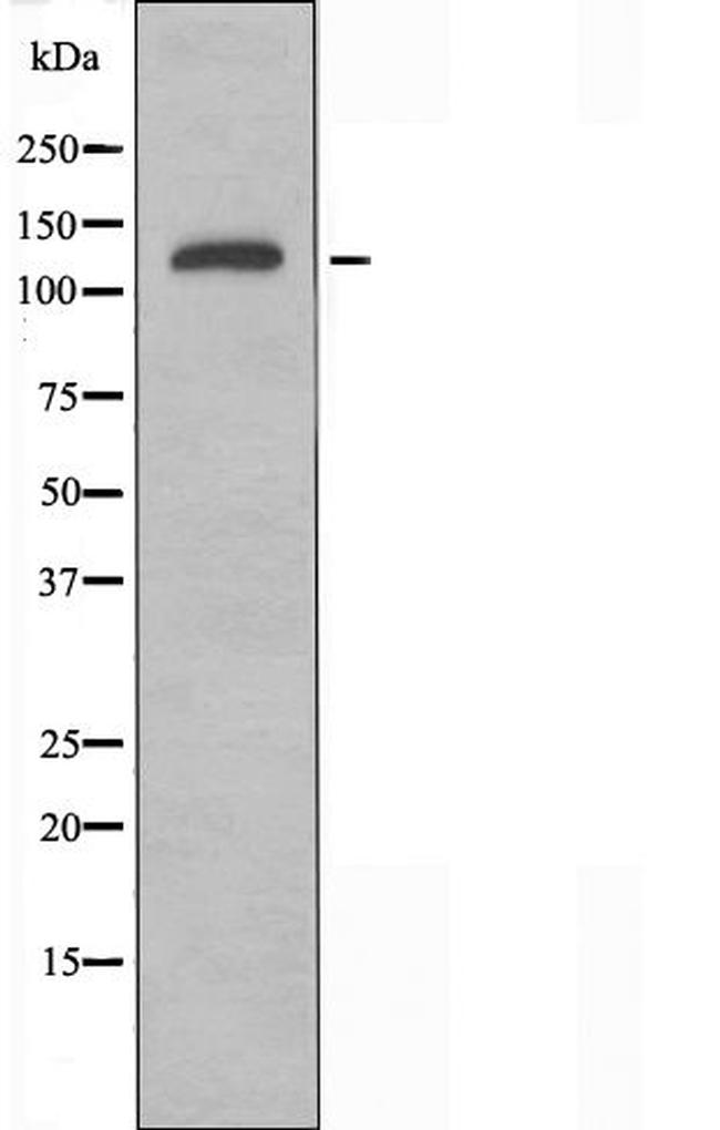 NUP160 Antibody in Western Blot (WB)