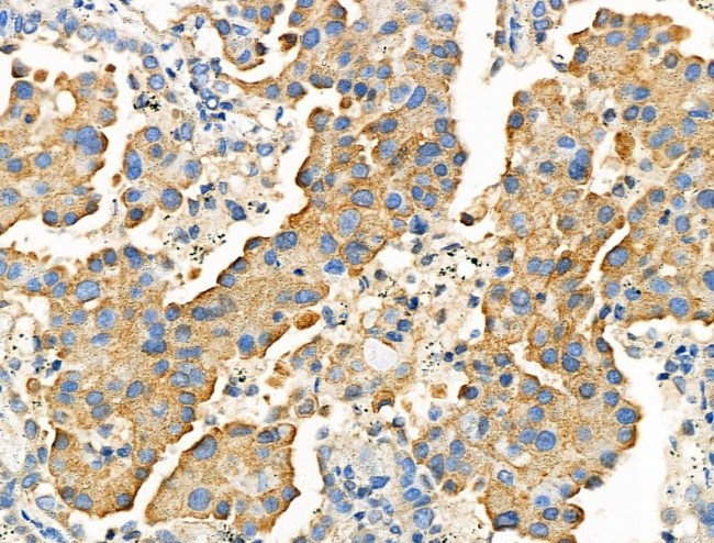 SLC15A1 Antibody in Immunohistochemistry (Paraffin) (IHC (P))