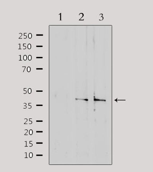 SLC15A1 Antibody in Western Blot (WB)
