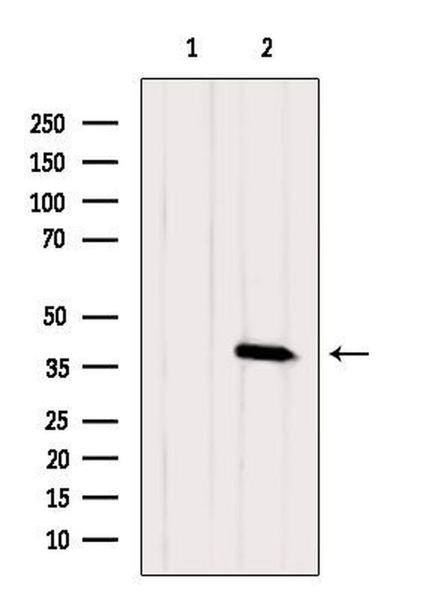 KCNK17 Antibody in Western Blot (WB)