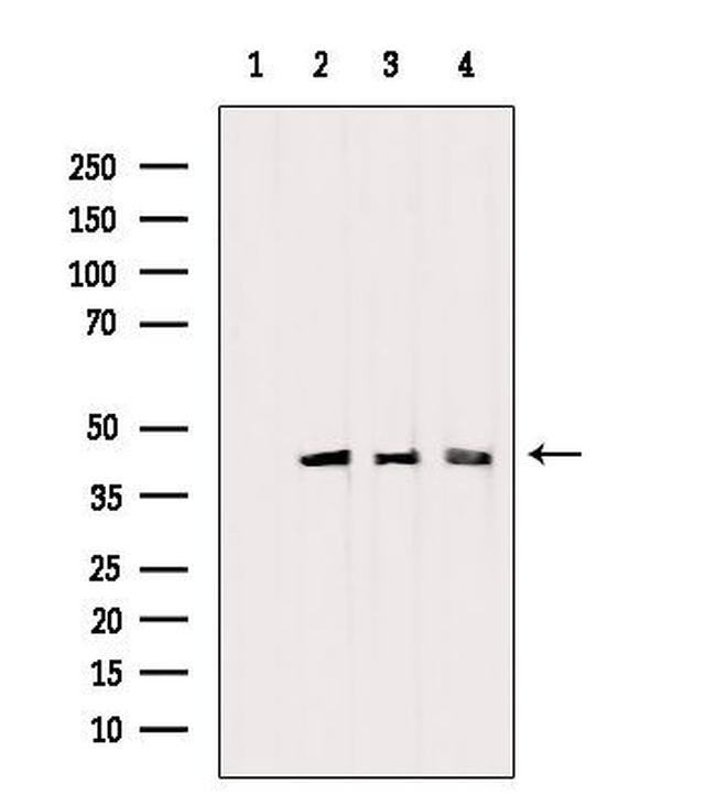 PDHA1 Antibody in Western Blot (WB)