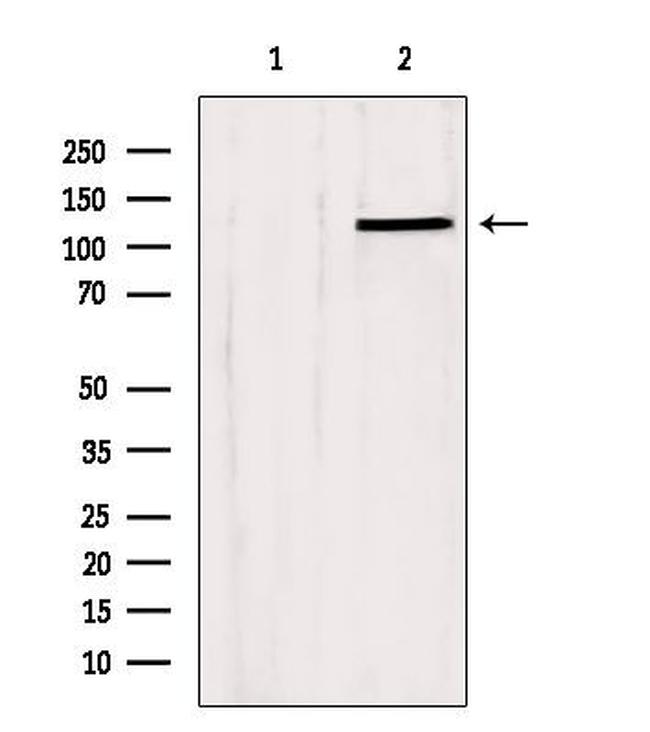 SLC24A1 Antibody in Western Blot (WB)