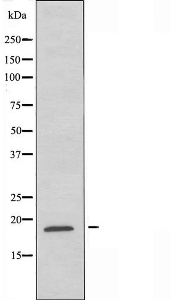 SNX3 Antibody in Western Blot (WB)