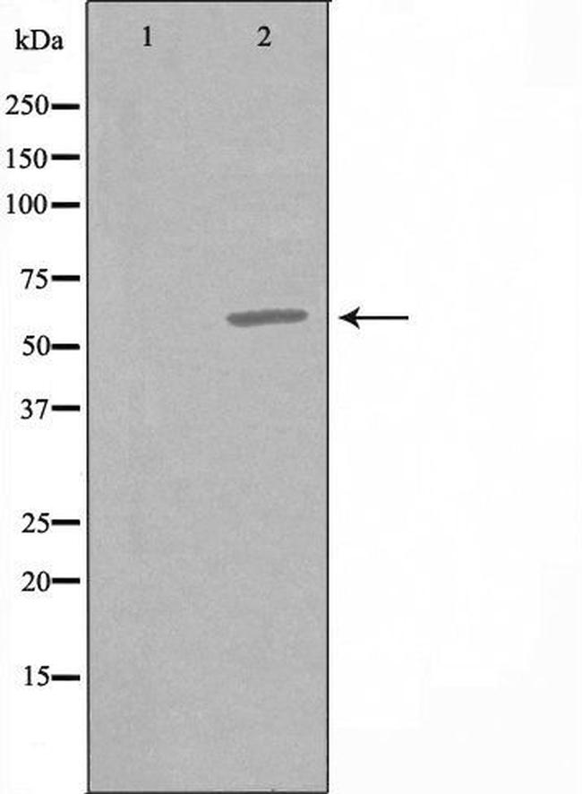 CCT6A Antibody in Western Blot (WB)