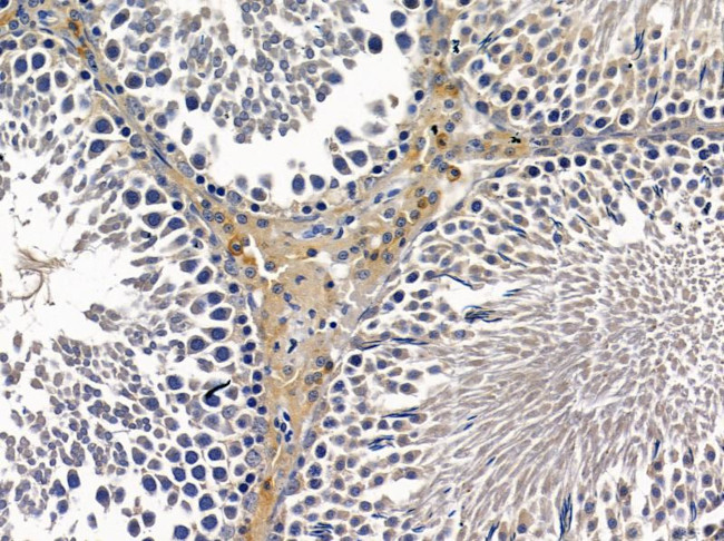 TSSK4 Antibody in Immunohistochemistry (Paraffin) (IHC (P))