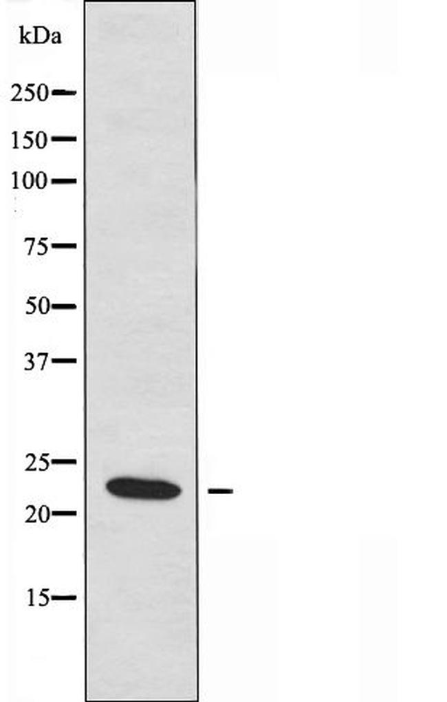 TRAPPC3 Antibody in Western Blot (WB)