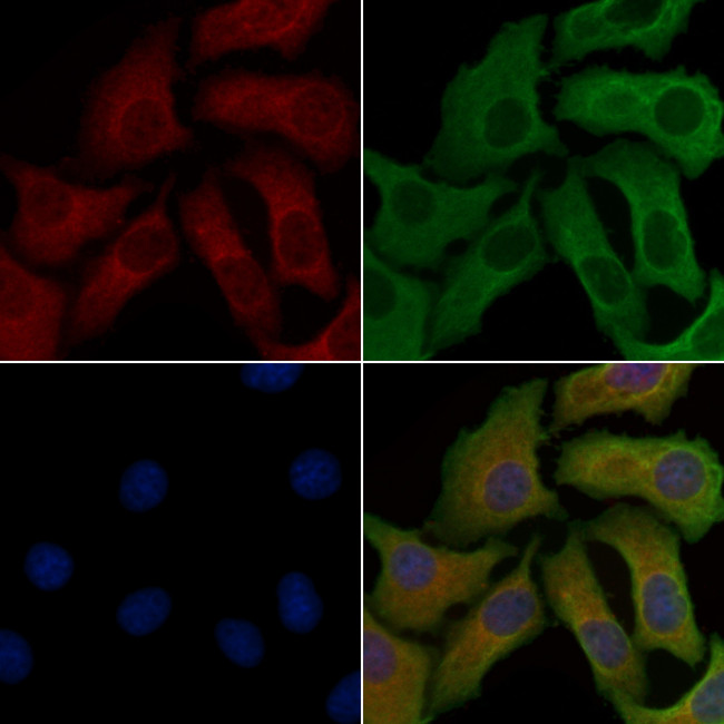 VPS26B Antibody in Immunocytochemistry (ICC/IF)