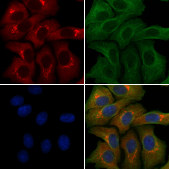 SLC39A9 Antibody in Immunocytochemistry (ICC/IF)