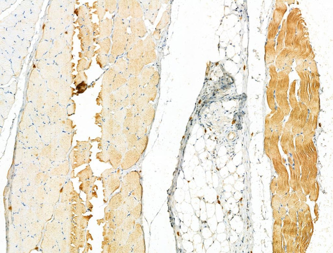 PTGIS Antibody in Immunohistochemistry (Paraffin) (IHC (P))