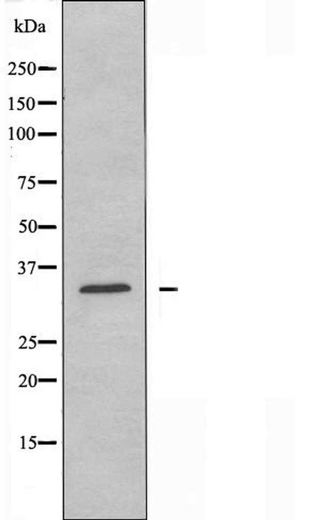 CYSLTR2 Antibody in Western Blot (WB)