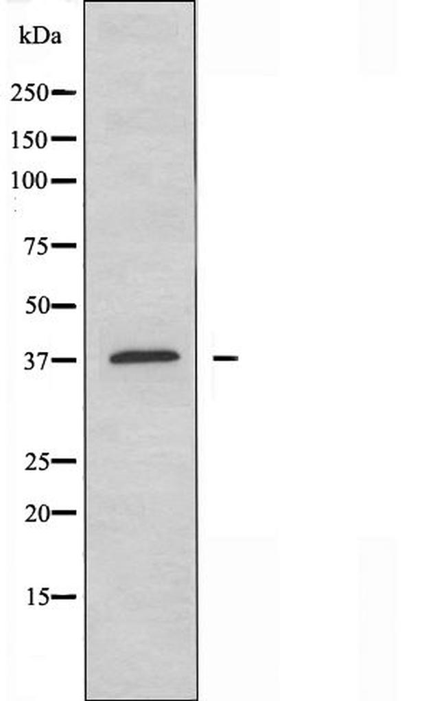 OR10D4P Antibody in Western Blot (WB)