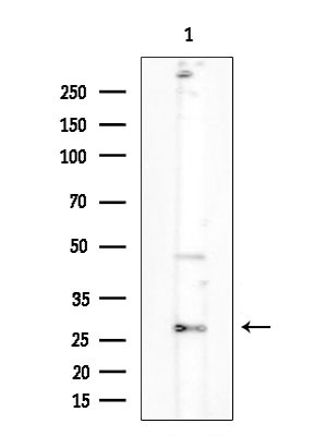 OR2D3 Antibody in Western Blot (WB)