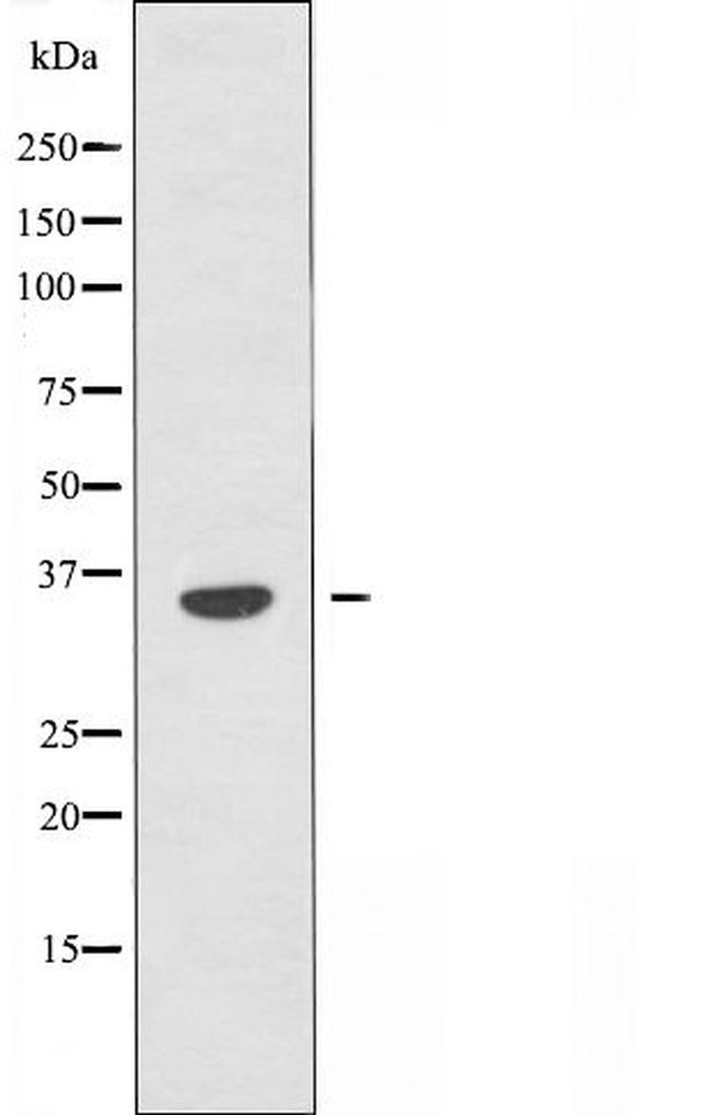 OR4D6 Antibody in Western Blot (WB)