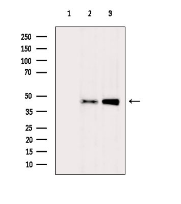 OR9Q2 Antibody in Western Blot (WB)