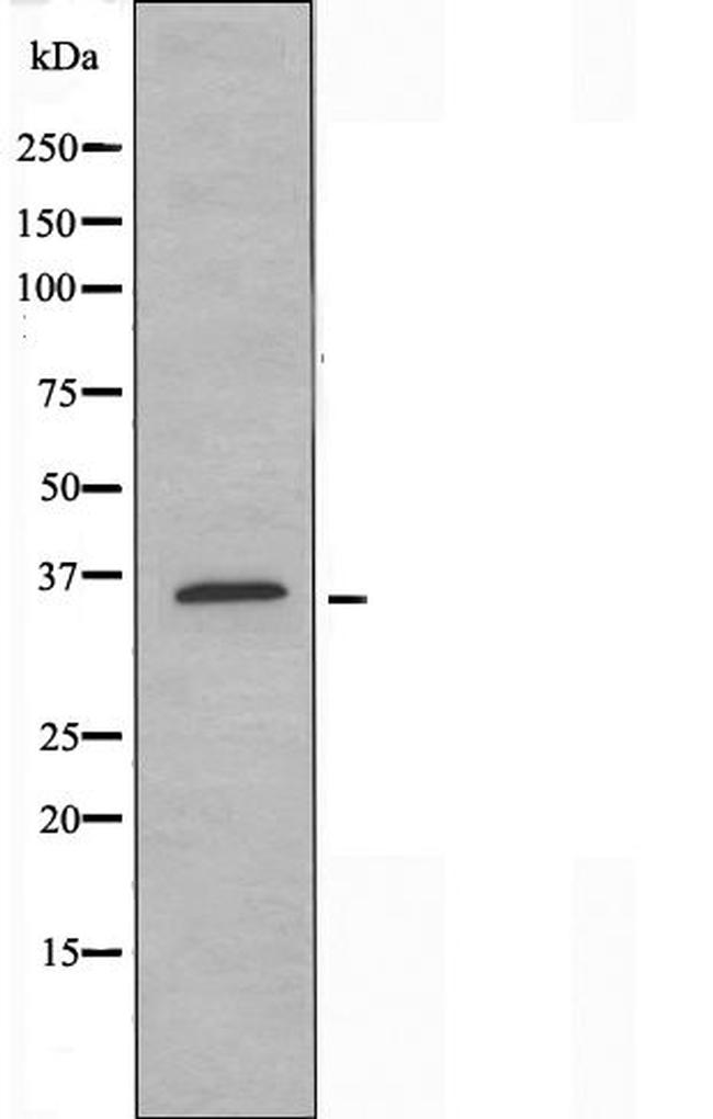 OR52N1 Antibody in Western Blot (WB)