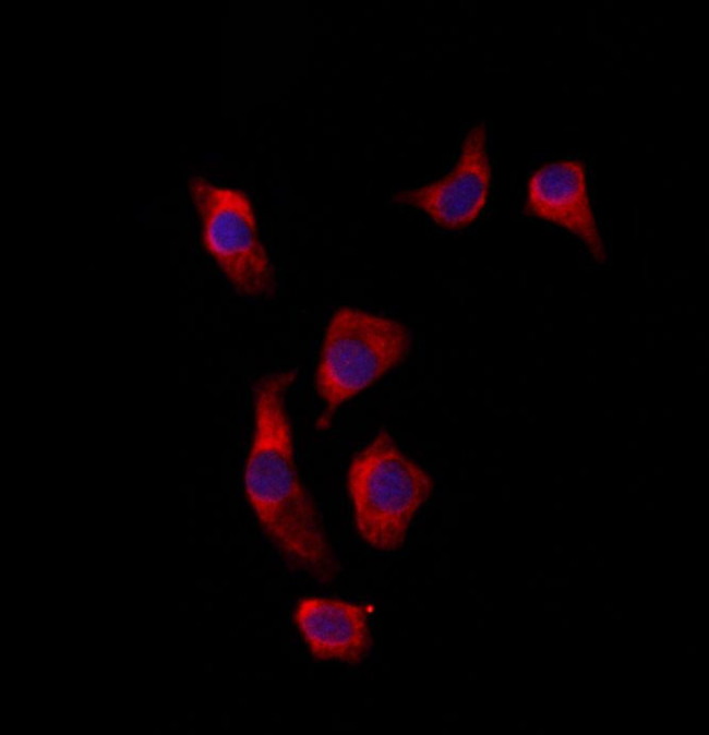 GSS Antibody in Immunocytochemistry (ICC/IF)